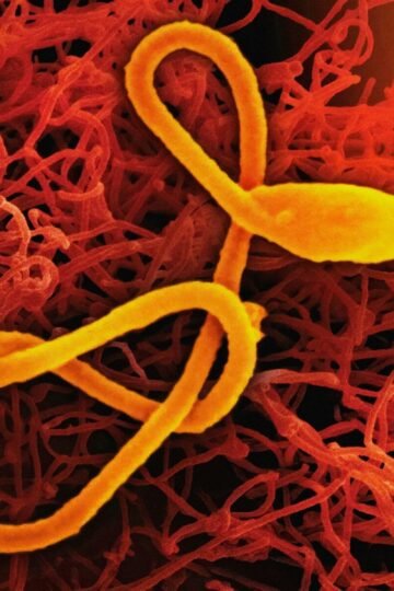 « Il faut empêcher qu’Ebola ne devienne une menace régionale et internationale »