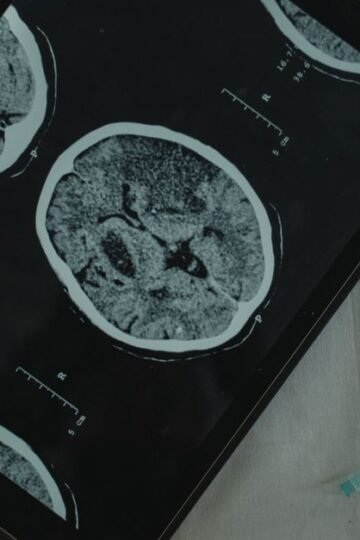 La complexité du cerveau et ses formidables capacités à découvrir dans tous leurs états à Futurapolis Santé 2026